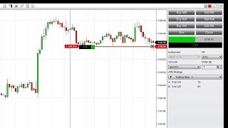 Configure an Automatic Trailing Stop [upl. by Swisher930]