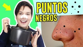 COMO SACAR PUNTOS NEGROS EN VIVO  REMEDIOS CASEROS  AndyZaturno [upl. by Dyob]