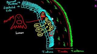 Atherosclerosis  Part 1 [upl. by Alleram]