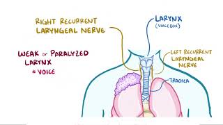 Pancoast Tumor aka Superior Sulcus tumor [upl. by Atoiganap]