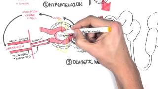 Chronic Kidney Disease CKD Pathophysiology [upl. by Llevol]