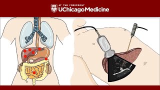 Hemorrhoids Lecture for USMLE [upl. by Lesna]