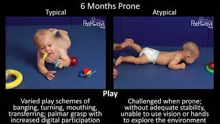 6 Month Old Baby Typical amp Atypical Development Side by Side [upl. by Colvert]