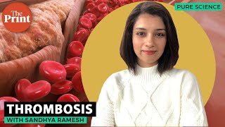 What is thrombosis [upl. by Eiveneg]