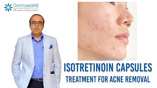 Isotretinoin capsules  Treatment for Acne removal  In Hindi  Dr Rohit Batra [upl. by Acirrej]