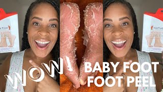 BABY FOOT EXFOLIATING FOOT PEEL IS BOMB FULL REVIEW [upl. by Quint729]