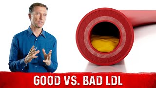 You Have Good and Bad LDL lowdensity lipoprotein [upl. by Assilla]