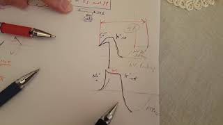 ECG made easy  Hyperkalemia amp Hypokalemia [upl. by Shari531]