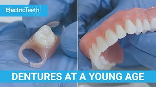 Dentures at a young age [upl. by Solegna]