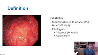 Gastritis vs Gastropathy [upl. by Adnor]