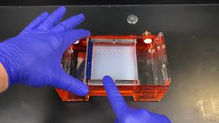 Agarose Gel Electrophoresis [upl. by Jacynth]