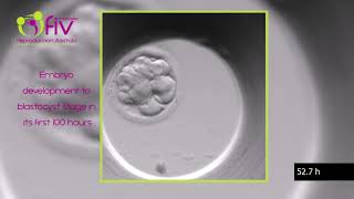 TimeLapse  Embryo development ENG first 100 hours [upl. by Oaht45]