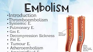 Embolism Pathology [upl. by Ayetal973]