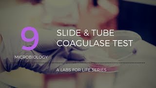 Slide and tube coagulase tests [upl. by Eibrik212]