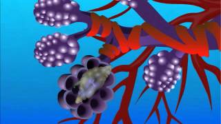 Aspergillosis – Type of Fungal Infection [upl. by Otrevogir54]