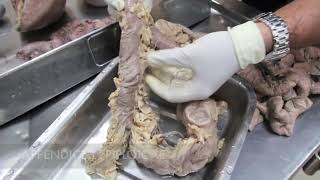 Introduction Neuroanatomy Video Lab  Brain Dissections [upl. by Nob]