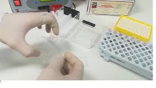 Hemoglobin electrophoresis procedure [upl. by Egbert]