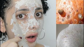 Mascarilla PEEL OFF Con Huevo Para QUITAR Puntos Negros en Minutos  Team Mechaz [upl. by Azarcon228]