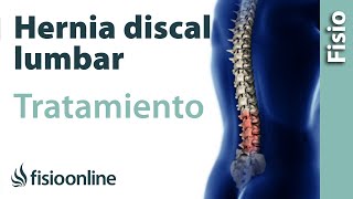 Hernia discal lumbar  Tratamiento con ejercicios automasajes y estiramientos [upl. by Cimah]