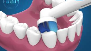 Como escovar os dentes com a escova de dentes elétrica [upl. by Dyke854]