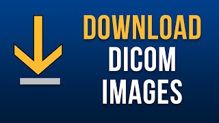 Where to Download DICOM Images [upl. by Namyw]