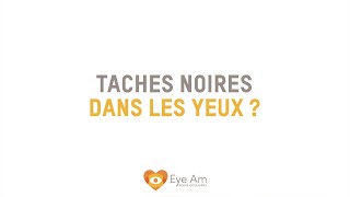 Apparition de taches noires dans les yeux [upl. by Kelcy]