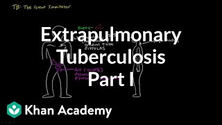 Extrapulmonary TB part 1  Infectious diseases  NCLEXRN  Khan Academy [upl. by Enrev]