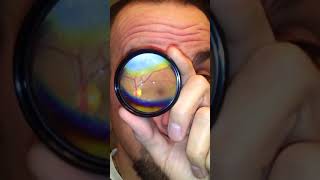 How to Do Your Own Fundus Exam [upl. by Grenville699]