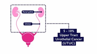 Normal Renal Anatomy [upl. by Bard]