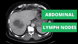 Overview of HRCT CT CHEST Imaging in Interstitial Lung Disease [upl. by Alvar626]