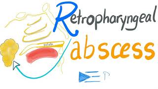 Retropharyngeal Abscess [upl. by Anchie]