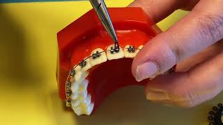 Replacing an OTie Small Rubber Band on your Braces [upl. by Yenruoc989]