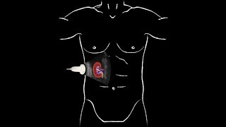 sheep kidney anatomy [upl. by Schwarz936]