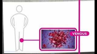 Venous Thrombosis Explained [upl. by Cecilia]