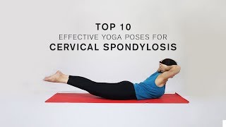 Top 10 Effective Yoga Poses for Cervical Spondylosis [upl. by Wilcox]