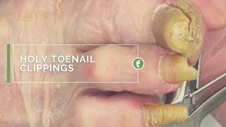 HOLY TOENAIL CLIPPINGS [upl. by Llerehs]