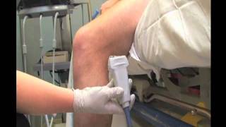 How To Deep Vein Thrombosis Detection with Ultrasound Part 1 Case Study Video [upl. by Enail486]