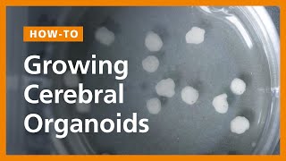 How to Grow Cerebral Organoids from Human Pluripotent Stem Cells [upl. by Langbehn613]