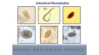 Diagnostic Features of Intestinal Nematodes [upl. by Yeoj]