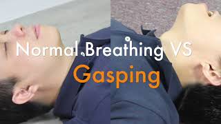 Sudden Cardiac Arrest SCA and Agonal Breathing Gasping [upl. by Hanzelin]