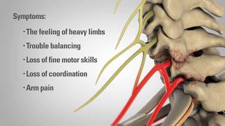 CERVICAL FACET JOINTS PALPATION TECHNIQUE 3PHASE METHOD [upl. by Gregorius794]