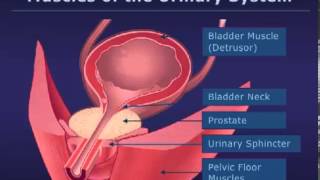 Botox Injections for Bladder Conditions [upl. by Aretse751]