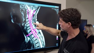 Symptoms of Cervical Stenosis  Jeffrey Cantor MD [upl. by Rori]