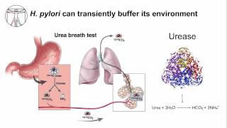 Gastritis H Pylori Persistence [upl. by Eilloh]