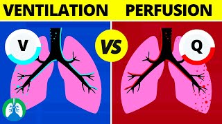 VentilationPerfusion VQ Ratio  Quick Medical Overview [upl. by Publia]