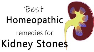 Best homeopathic medicine for stone in kidney  Dr Sanjay Panicker [upl. by Adnavoj]