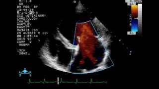 Echocardiography to Assess MitralValve Leaflets  NEJM [upl. by Iruyas]