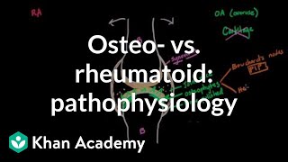 Immunology of the rheumatoid joint [upl. by Tebasile]