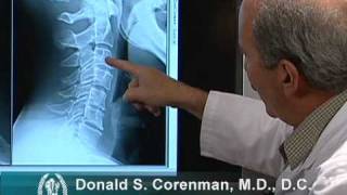 How to Read Xrays of the Cervical Spine Neck  Colorado Spine Expert [upl. by Hevak]