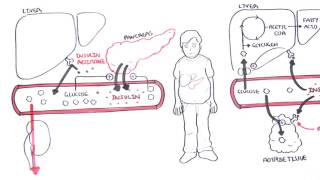 Diabetes Type II Pathophysiology [upl. by Seiden679]